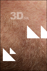  HD Face Skin Erling 
