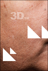  HD Face Skin John Deery 