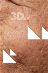  HD Face Skin Takemoto Junzo 