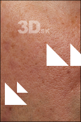  HD Face Skin Harrison Hill 