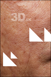  HD Face Skin Ike Hidetsugu 