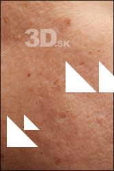  HD Face Skin Alfredo Zorita 