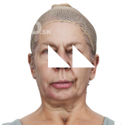 Abigail Morris Raw Head Scan