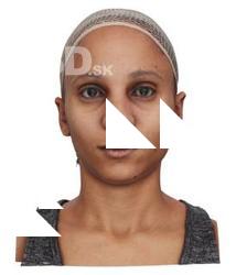 Aisha Bonobo Raw Head Scan