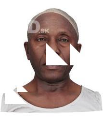 Dimetrice Moss Raw Head Scan