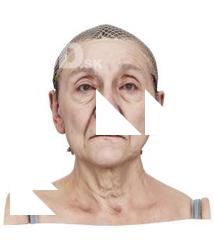 Isla Cole Raw Head Scan