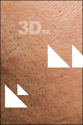  HD Face Skin Henri Sanaky 