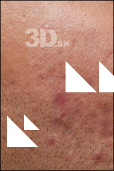  HD Face Skin Ithamar Jung 