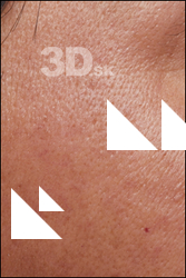  HD Face Skin Luis Gallo 