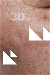  HD Face Skin Abdul Gyrot 