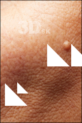  HD Face Skin Bayarmaa Bulga 