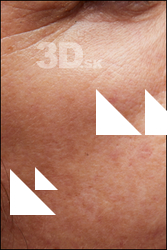  HD Face Skin Alba Palacio 
