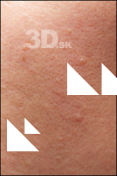  HD Face Skin Lyle 