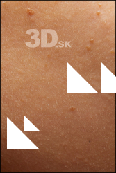  HD Face Skin Candela Ros 