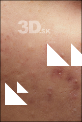  HD Face Skin Jessie Clark 