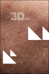  HD Face Skin Chase 