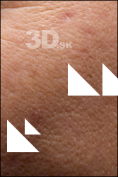  HD Face Skin Hanane 
