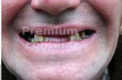 Teeth Man White Average