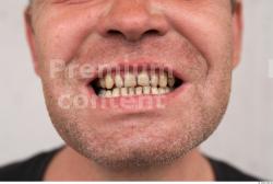 Teeth Man White Casual Average