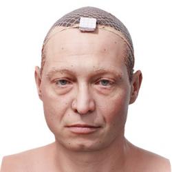 Vitalij Ferguson Raw Head Scan